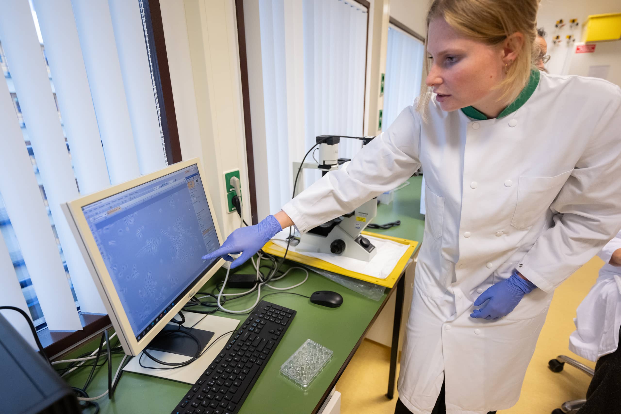 PhD student Jolien Wichers Schreur (LUMC) shows microscope image of skin cells on screen