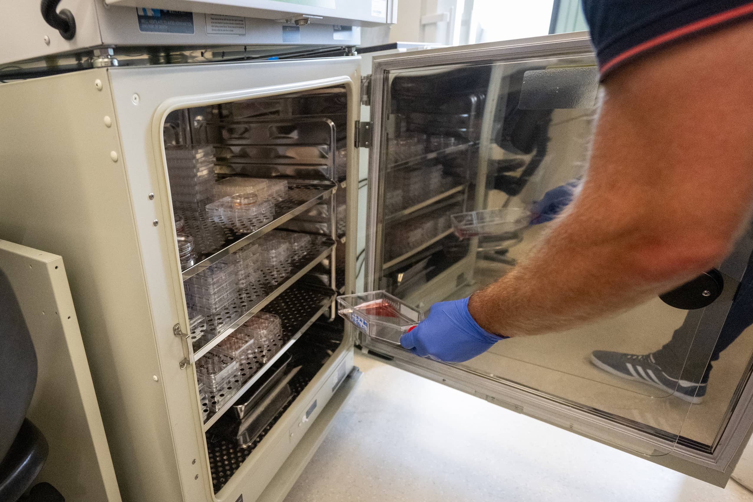 Dr Ronald Buijsen takes culture bottle with brain cells