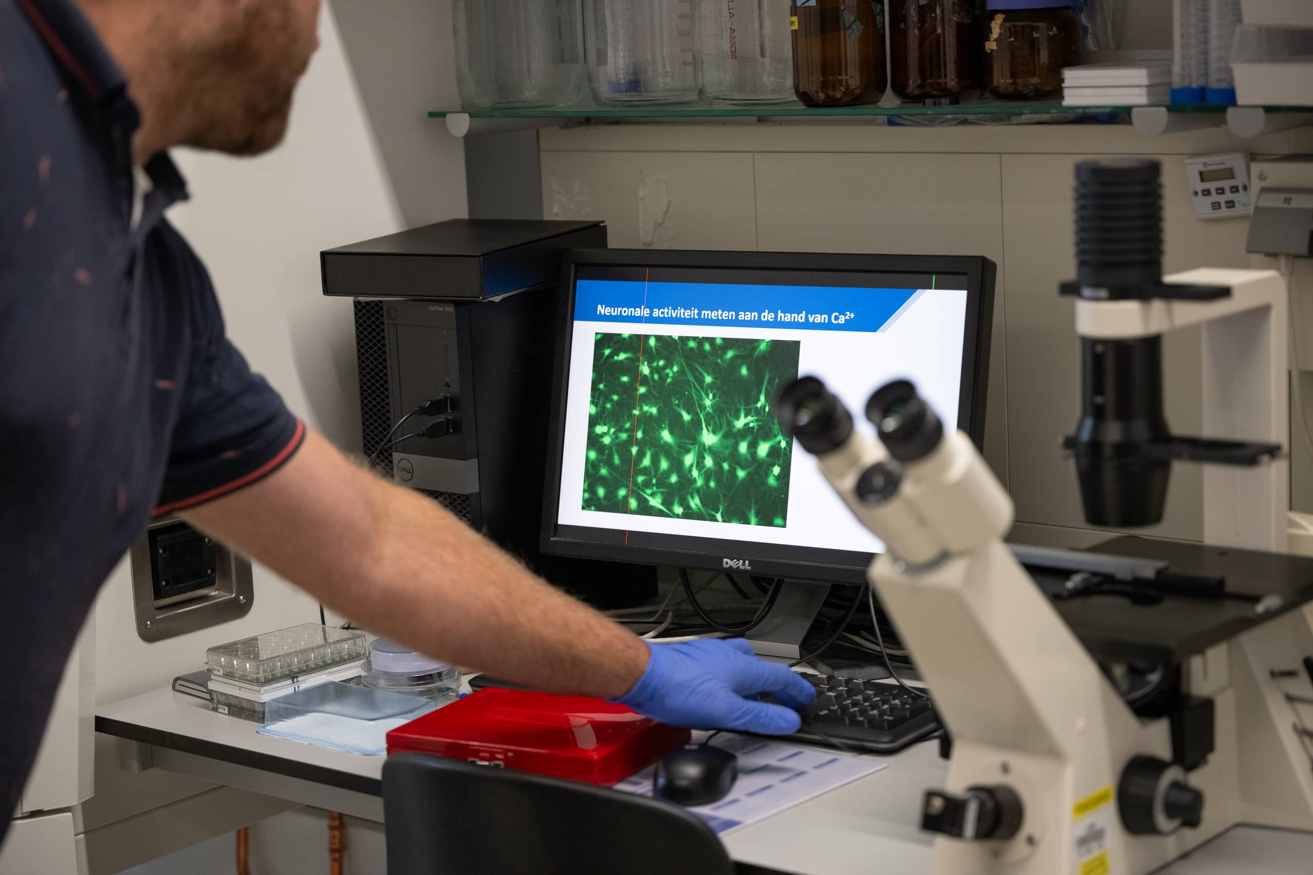 Imaging on screen of 3D brain model