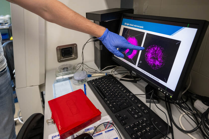 Labeled brain cells in an organoid can be demonstrated by 3D microscopy.